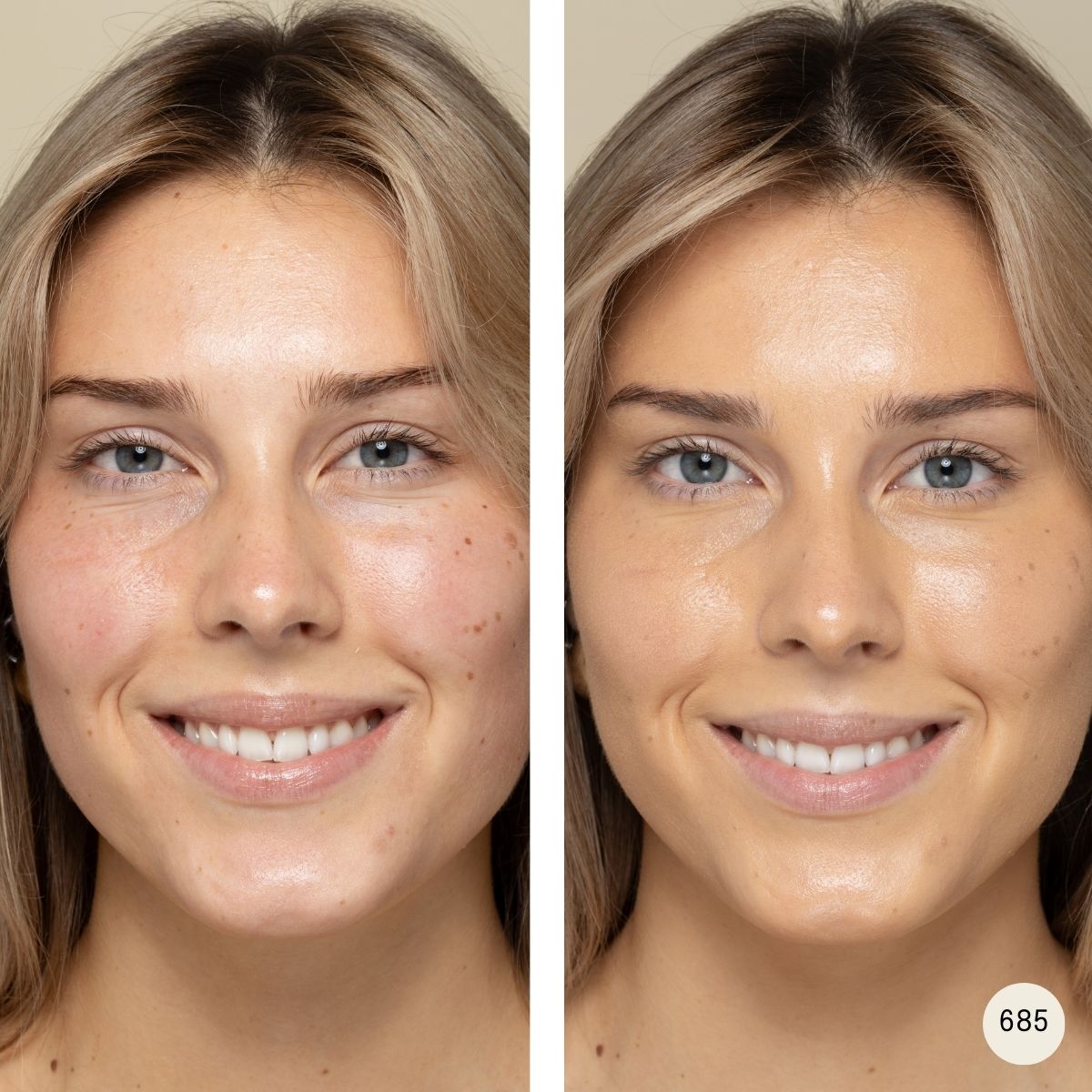 Минерален серум фон дьо тен – Uoga Uoga